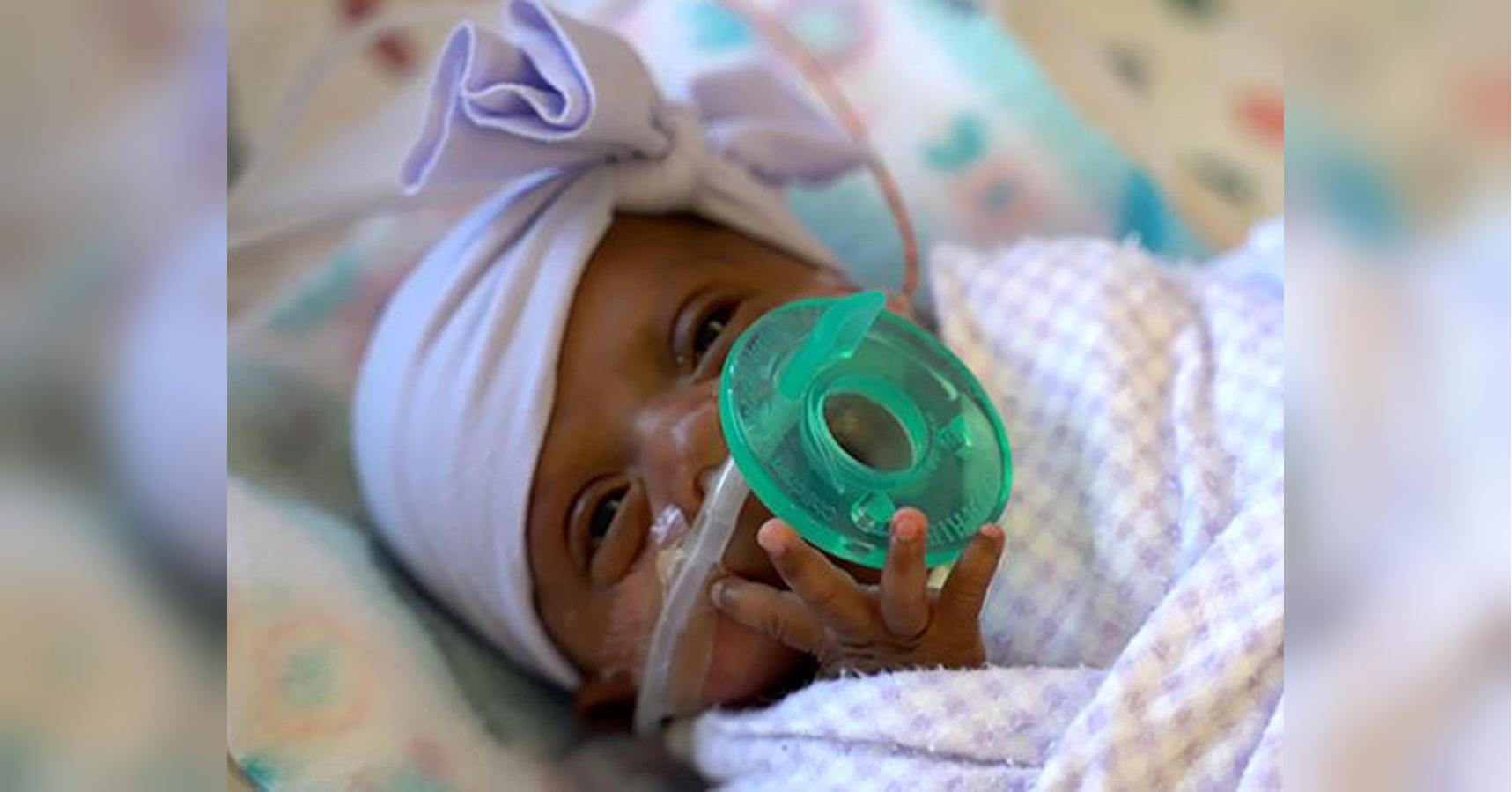 Американские врачи выходили самого маленького в мире младенца