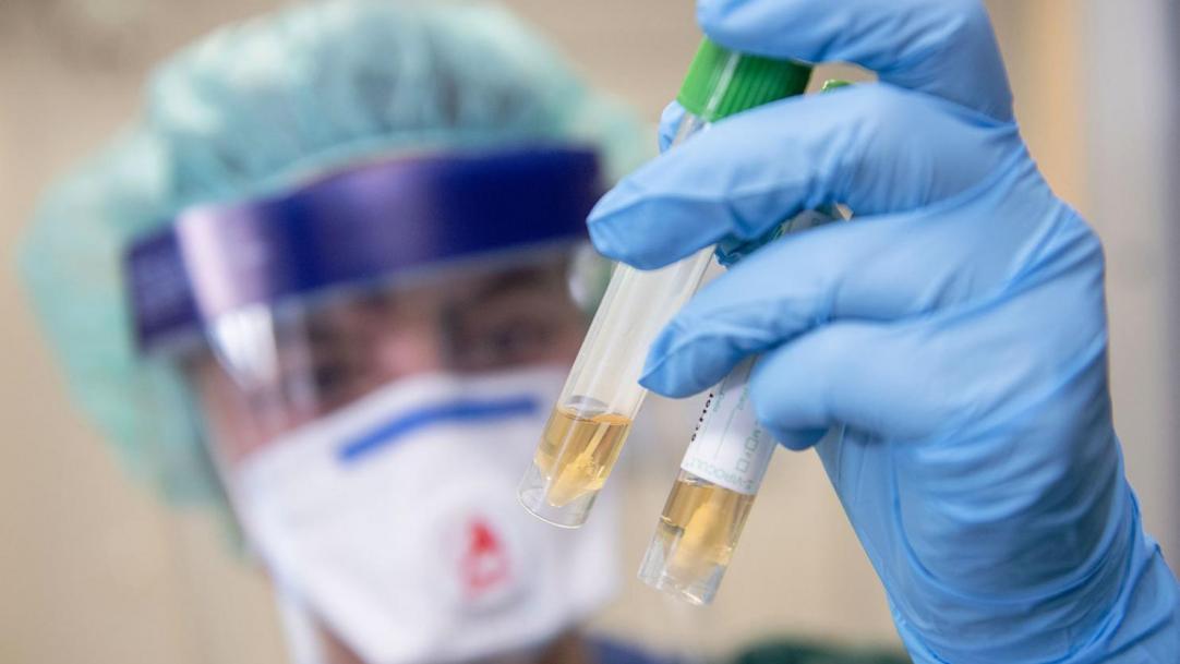 Россия побила рекорд по числу заболевших коронавирусом